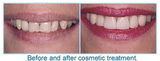 BEST COSMETIC TREATMENT IN PATNA