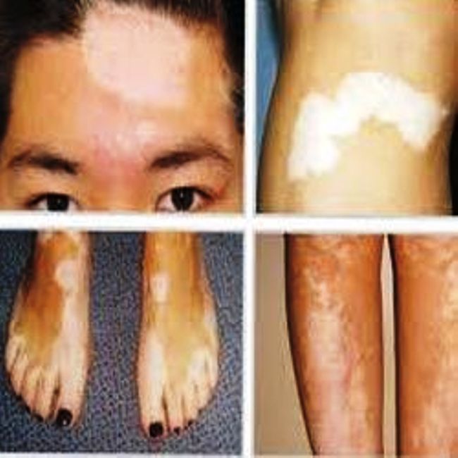 skin care treatment in daltonganj 