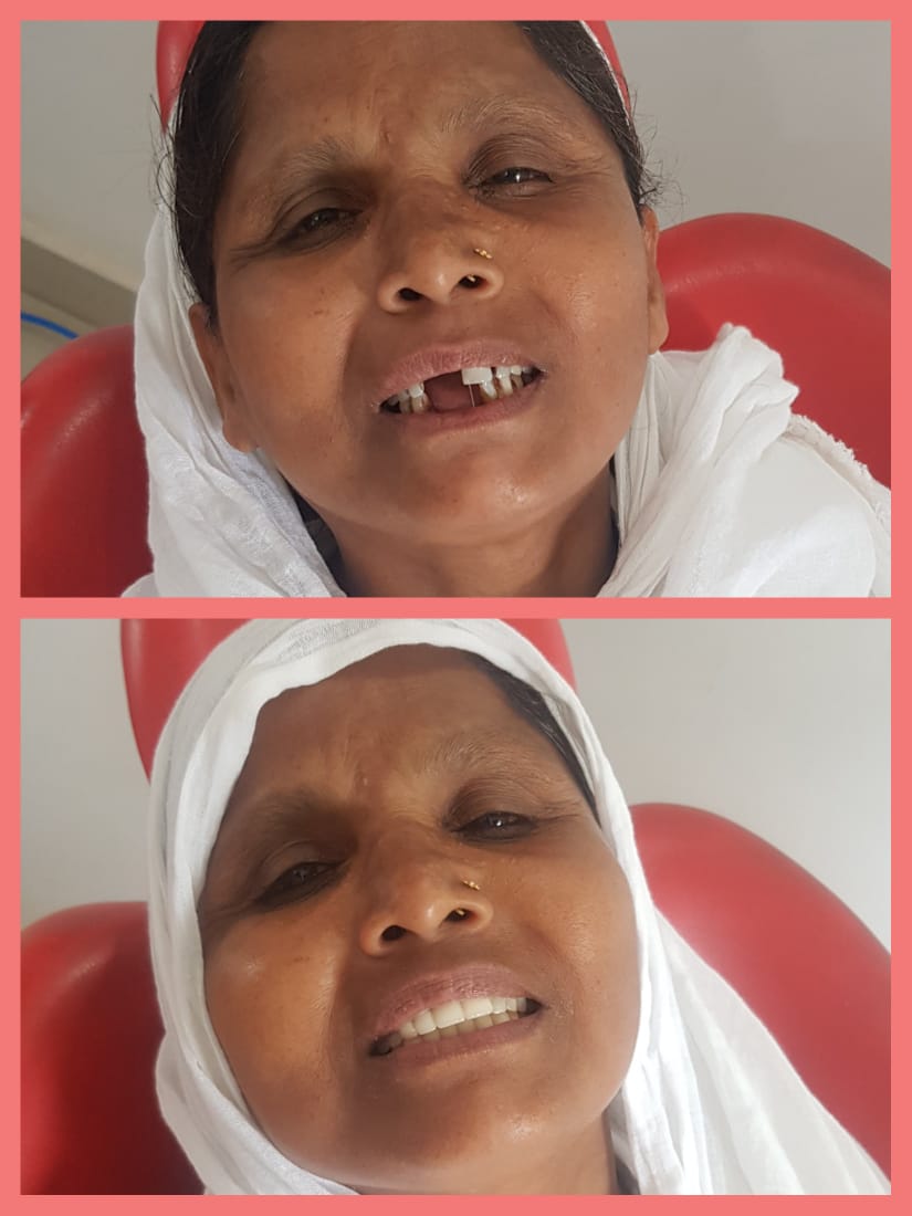 best dentist in hazaribagh