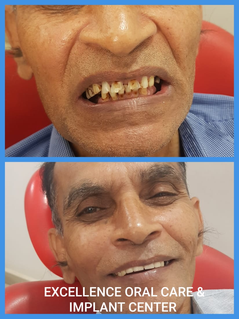 best dental clinic in hazaribagh